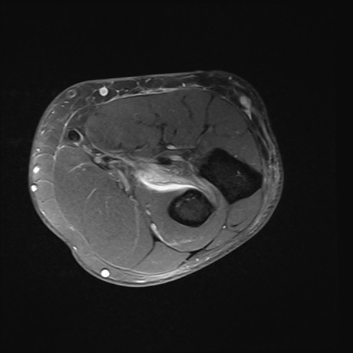 Click on the Serie image to view the images of Wieszt, Gnter